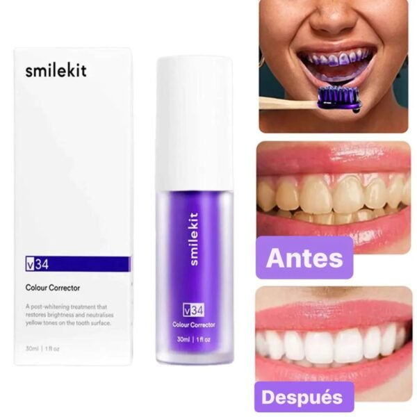 Blanqueador de dientes - Imagen 2
