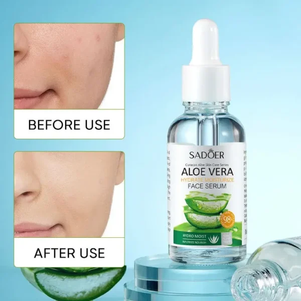Esencia Facial Calmante e Hidratante 100% Natural con Aloe Vera – Hidratación y Regeneración Profunda - Imagen 3