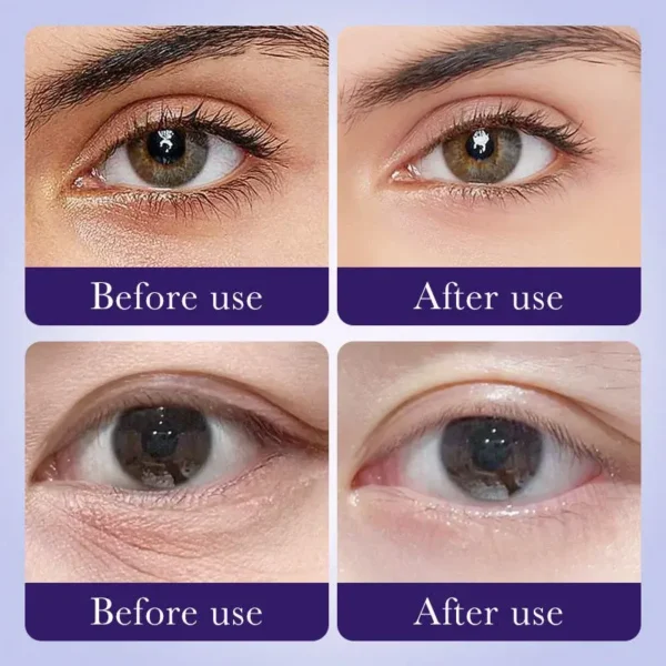 Parches Reafirmantes para Ojos con 60% de AHA + Antioxidantes (60 piezas) - Imagen 2