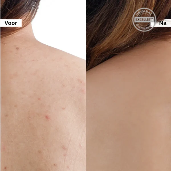 Crema Facial Reafirmante de Poros con Sal Rosa – 50g - Imagen 5