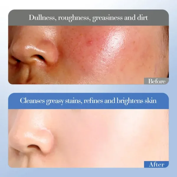 Crema Facial Hidratante Profunda – Iluminadora con Niacinamida y Arroz (50g) - Imagen 2