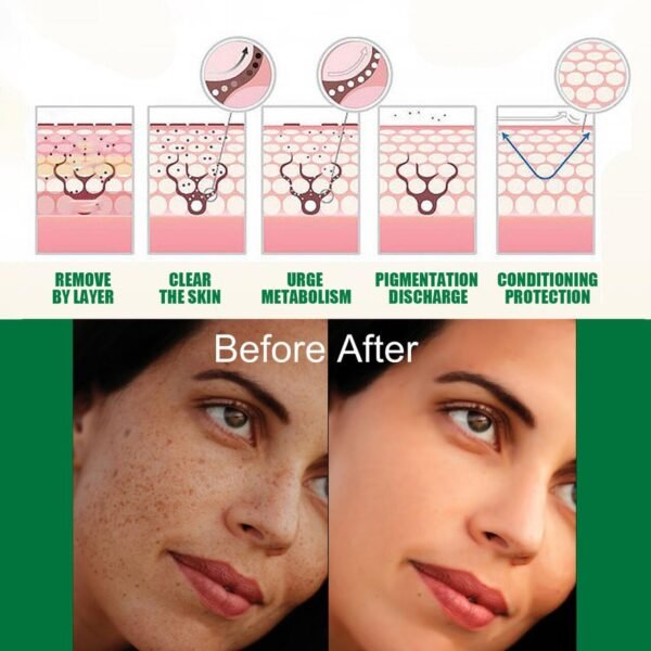 Sérum Iluminador Corrector de Manchas Oscuras EELHOE 50ml – Piel Radiante, Uniforme y Sin Imperfecciones - Imagen 2