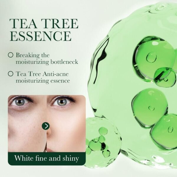 Crema Facial Control del Acné con Aceite de Árbol de Té 50ml SADOER – Purifica, Calma y Regula el Exceso de Grasa - Imagen 2