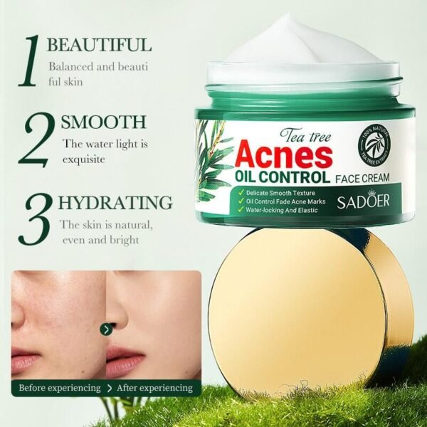 Crema Facial Control del Acné con Aceite de Árbol de Té 50ml SADOER – Purifica, Calma y Regula el Exceso de Grasa - Imagen 4