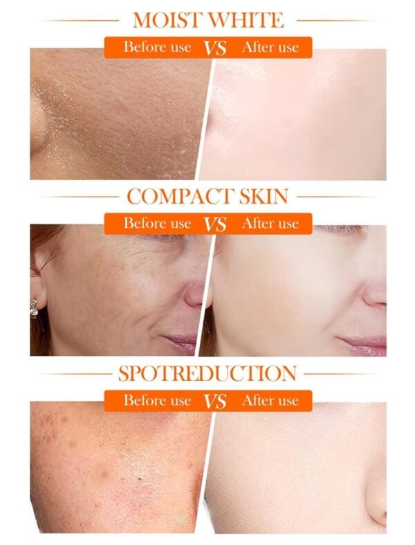 Crema Facial Blanqueadora Iluminadora 5 en 1 con Vitamina C Activa + Niacinamida – Piel Radiante en Cada Aplicación - Imagen 6