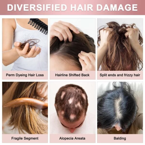 Sprays Para Favorecer el Crecimiento del Cabello y Mejorar la Salud del Cuero Cabelludo - Imagen 2